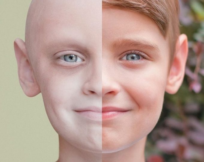 Cancerul și vindecarea
